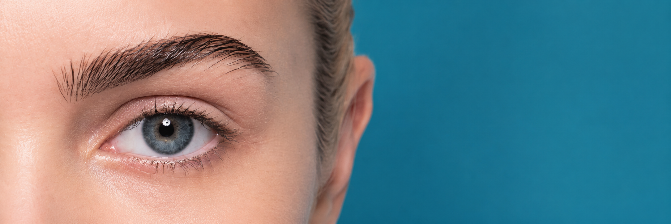 Eyebrow Restoration by DHI